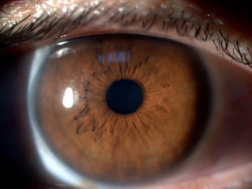 Close up of eye with raindrop inlay